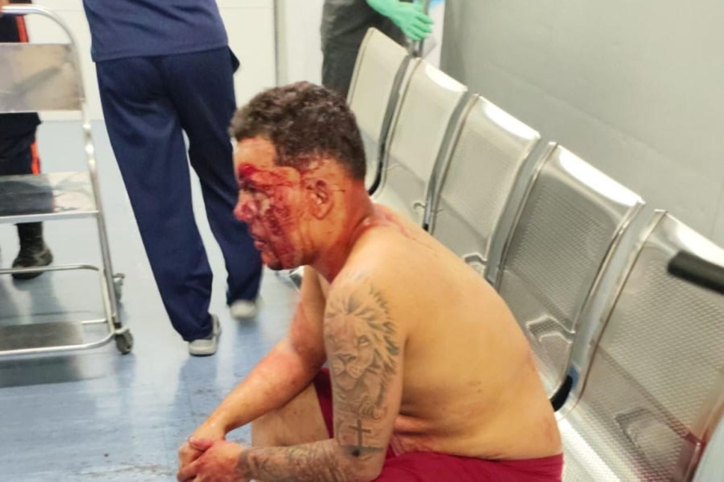 VÍDEO: Briga de torcidas organizadas no Tanque deixa duas pessoas em estado grave antes de Flamengo x Vasco